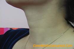 SW0171