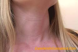 SW0177