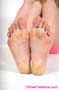feet-leg_a22_0558